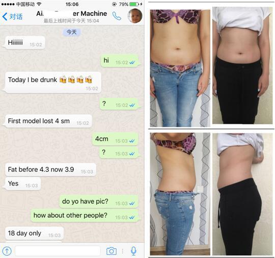 2016 newst!! -15oC 5 handles cryolipolysis fat reduction/ fat freezing slimming