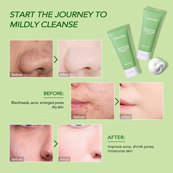 Facial Cleanser for Men and Women Deep Cleansing Shrinking Pores Moisturizing and Moisturizing Face Wash