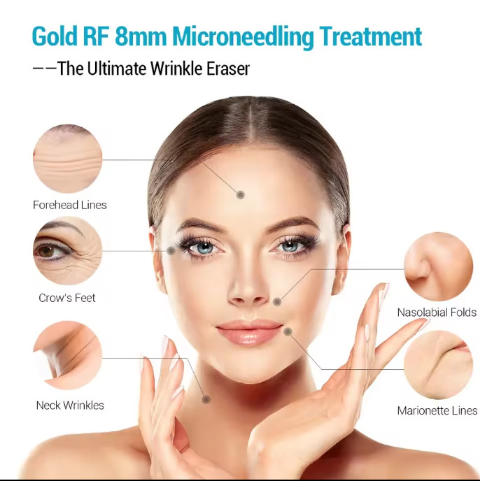 Hot Sale Fractional RF Reduce Fat Face Lifting Skin Tightening Microneedle morpheus 8 Machine
