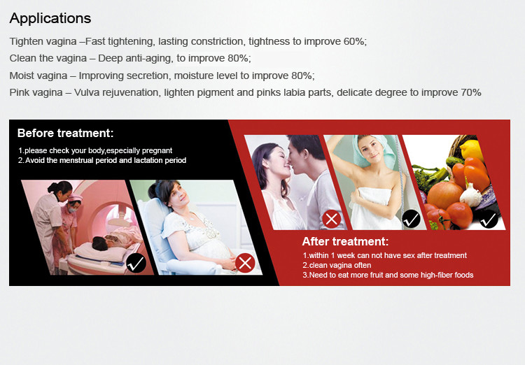 4d Fotona Skin CO2 Fractional Laser Machine For Vaginal Warts Stretch Marks Removal