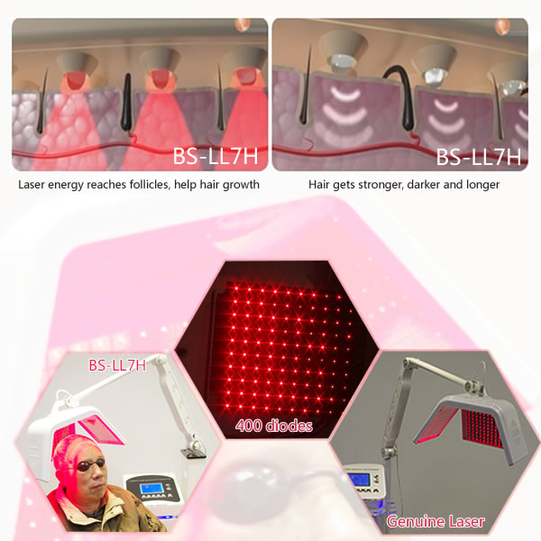 Laser hair regrowth equipment Low Level Diode Laser male female pattern baldness treatment hair regrowth machine
