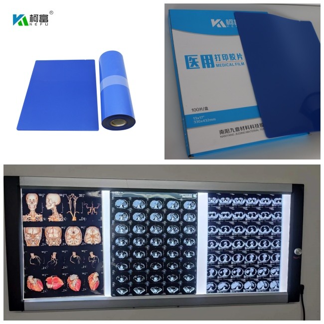 Inkjet Medical X Ray Film for Canon Printer Epson Printer