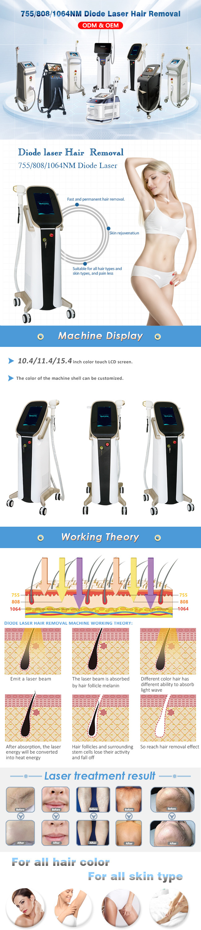 600watt 755 808 1064 Diode Triple Wavelength Laser Permanent Hair Reduction 10J/Cm2