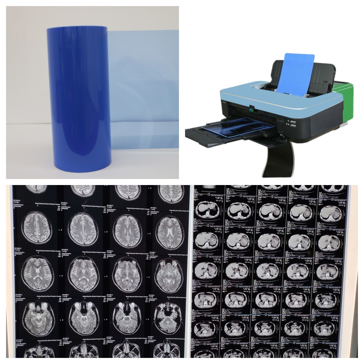 Inkjet Medical X Ray Film for Canon Printer Epson Printer