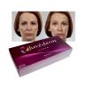 Buy cheap Ultra3 Juvederm Hyaluronic Acid Dermal Filler 20mg/Ml Lip Enhancement Fillers from wholesalers