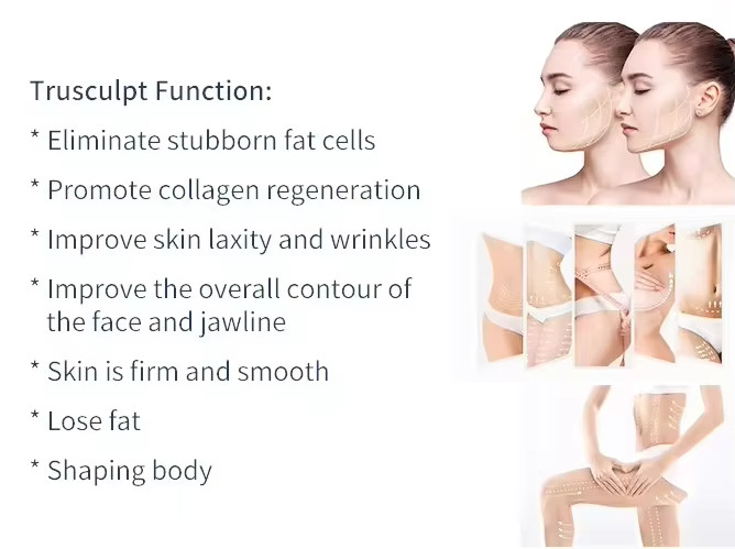 Trusculpt Flex 3D Weight Loss Face And Body Sculpting RF Trusculpt Machine