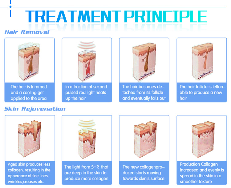 Europe hottest intense pulsed light hair removal skin rejuvenation machine machine ipl hair removal equipment