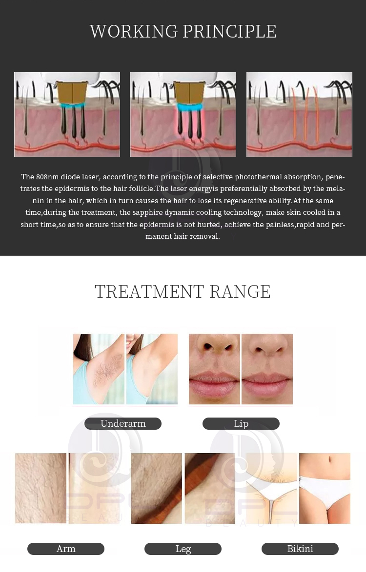 High Quality Nd Yag Laser Portable 808 Diode Laser Hair Removal Machine Instrument