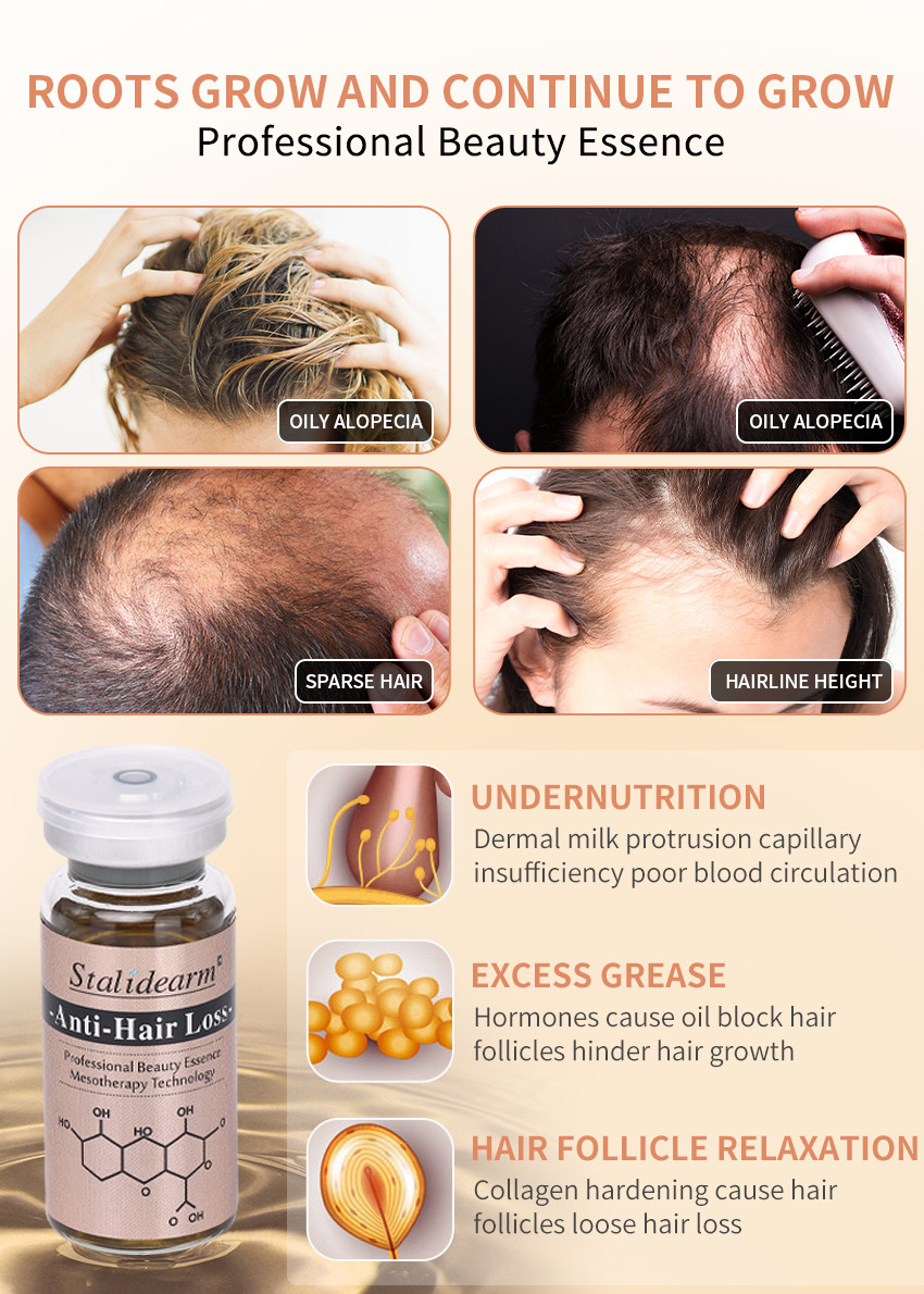 10ml Anti Hair Loss Serum Liquid Set Hair Care Growth Treatment Hair-Loss Prevention Essence