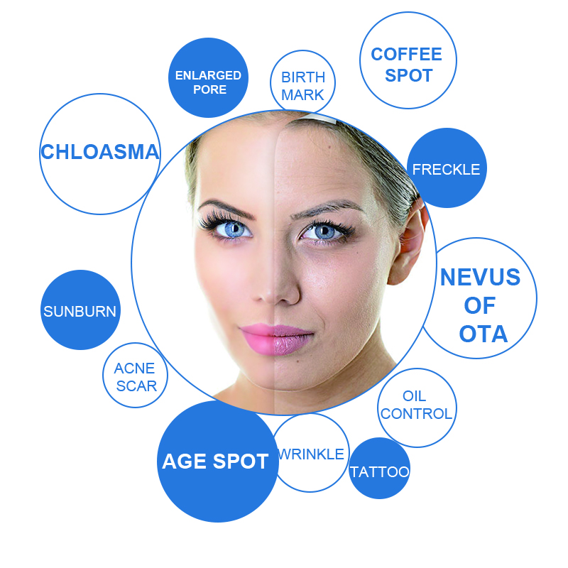 2018 trending products 755 laser picosure pigment removal