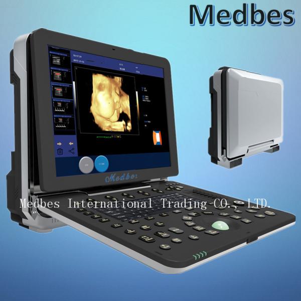 4D Color Doppler Ultrasound Diagnosis System4D Portable Vascular Ultrasound