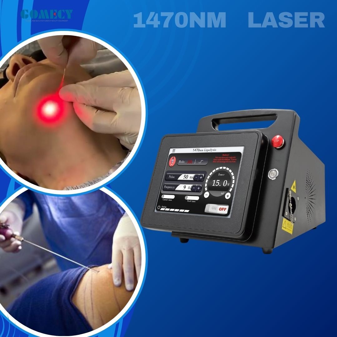 1470nm Face Lifting Lipolysis Laser Liposuction Machine Laser Fat Removal Endo Face Lifting 1470nm Machine