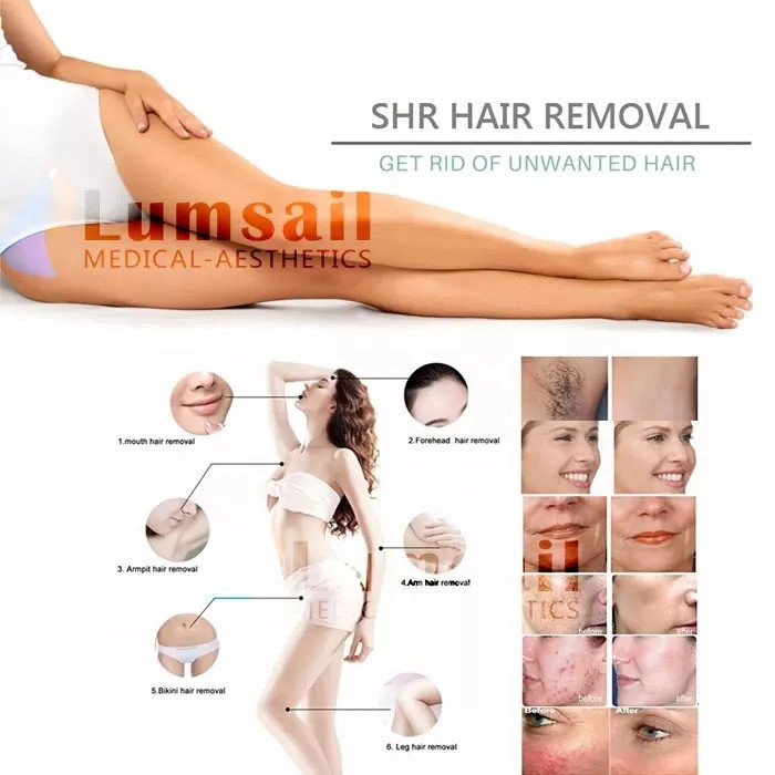 Stationary Painless Commercial Laser Hair Removal Machine With 2 Cooling Fans