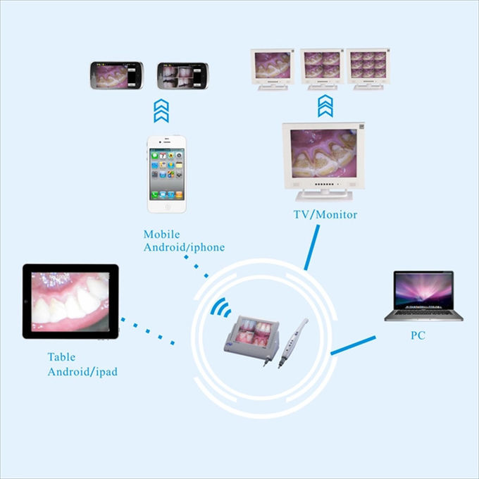 Dentist Intra Oral Camera 8 Mega Mouth Mirror Scanner Endoscope With 8 Inch Monitor