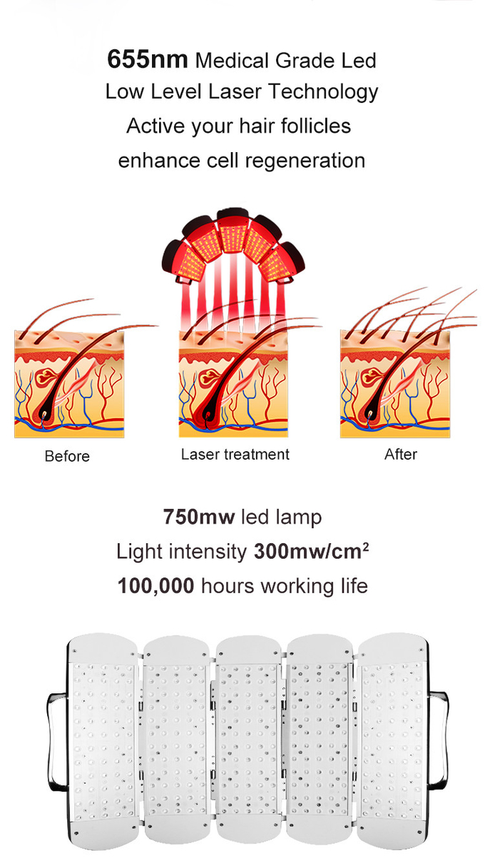 650nm Laser Hair Growth Machine - Stimulates Hair Follicles for Fuller, Healthier Hair