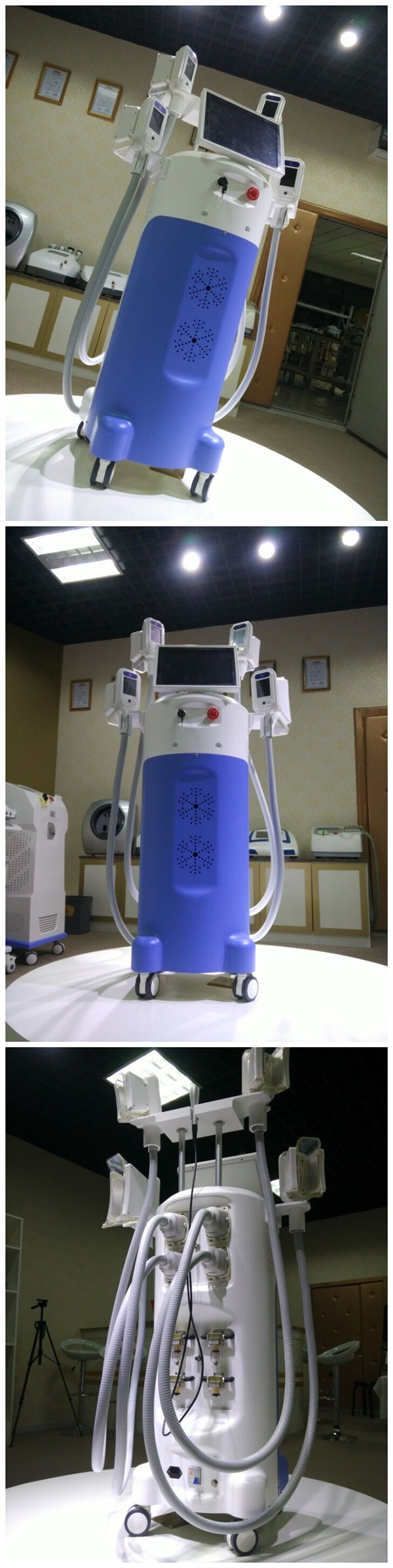 cryolipolysis C4.jpg