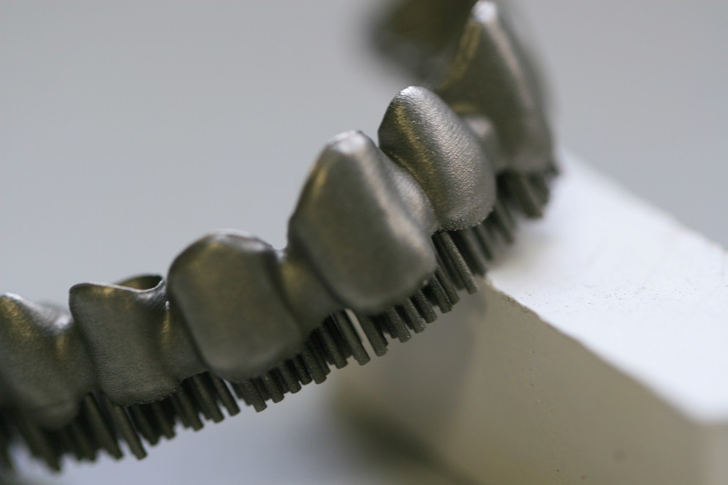 Metal Ceramic Good Fitness PFM Dental Crown