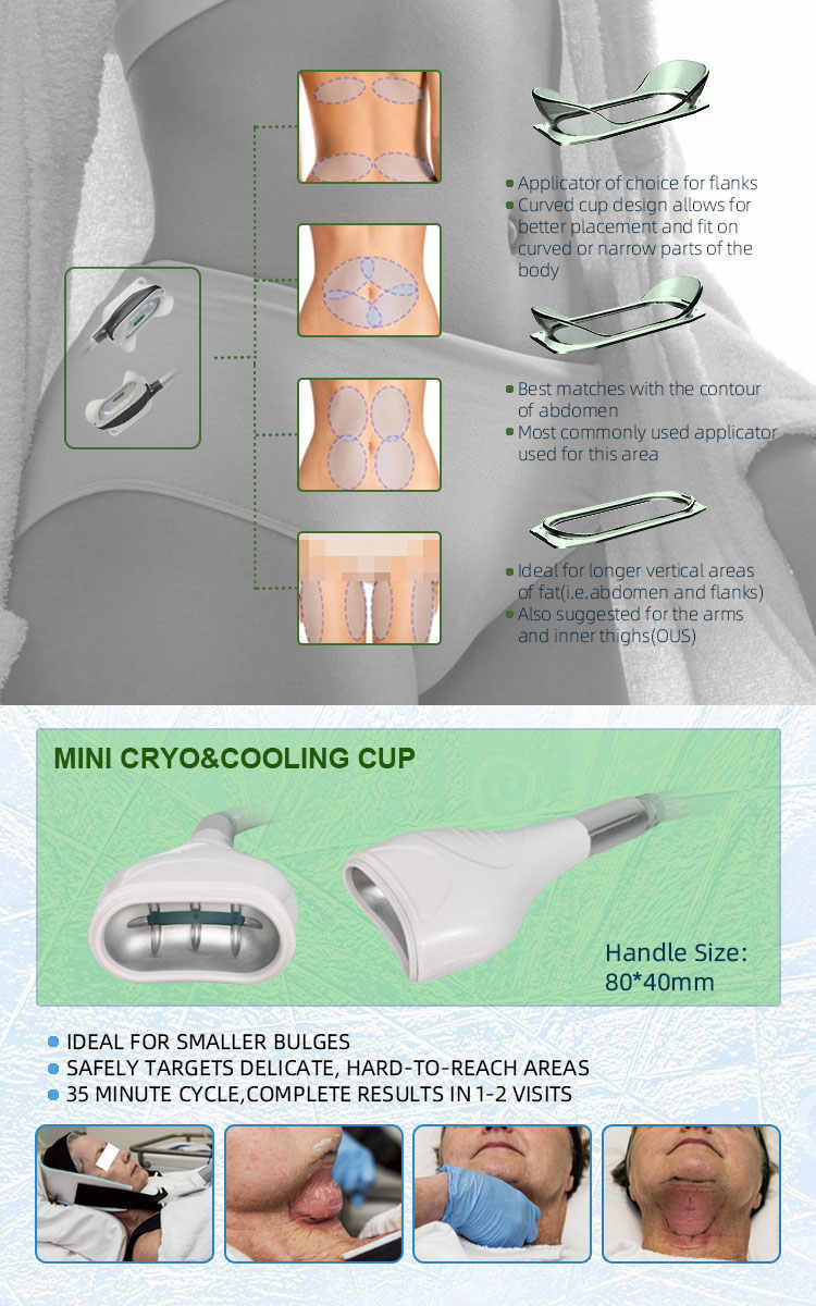 Beauty Salon 800W Cryolipolysis Machine 7 Handles With RF Cavitation