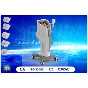 High Intensity Focused Ultrasound HIFU Device Removal Double Chins