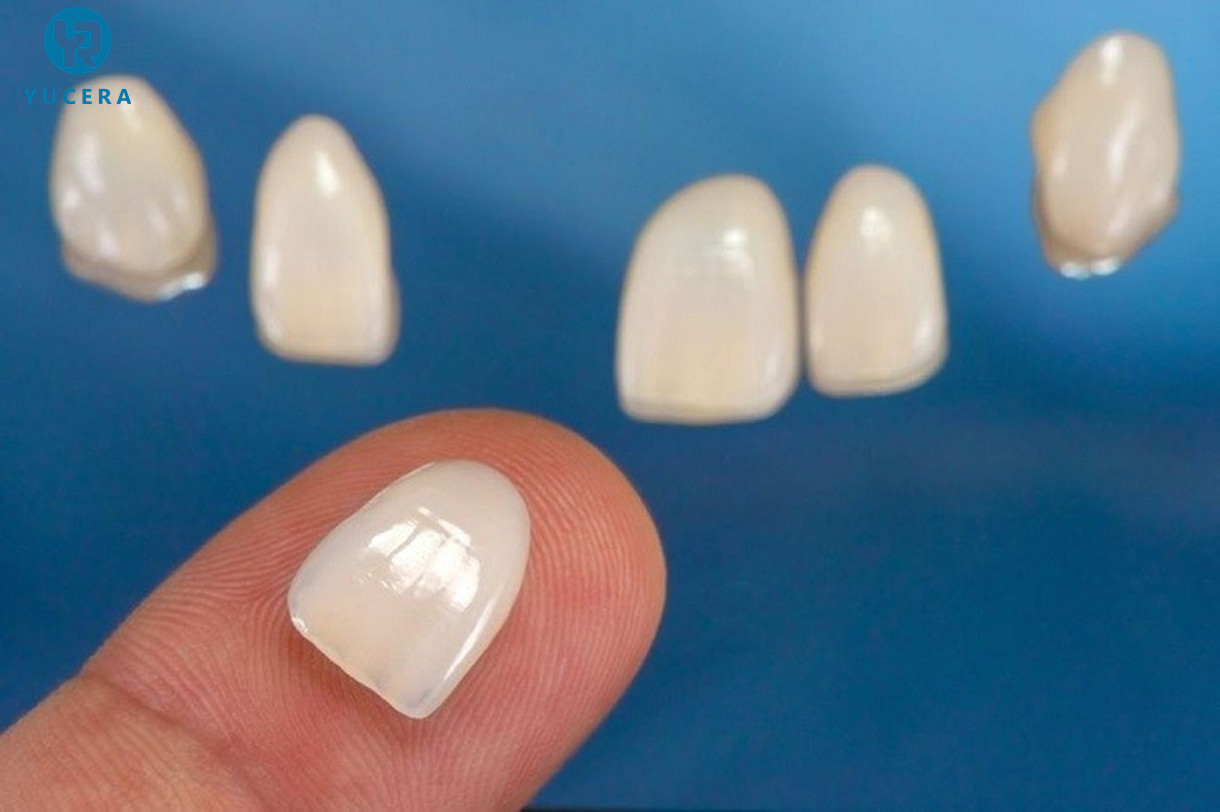 Affordable Price China lithium disilicate dental glass ceramic block 5Pcs/ Lot HT Dental Press Ingots