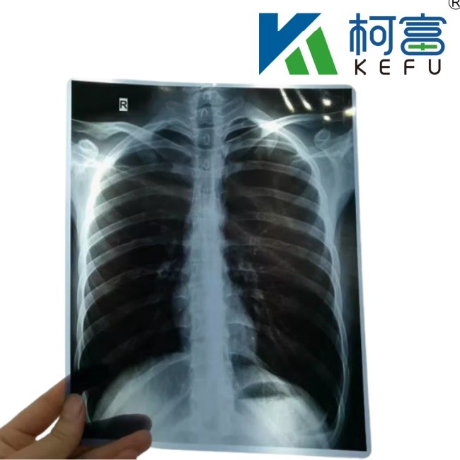 High Definition Medical Imaging CT DR Inkjet Medical X-ray Pet Film 175mic 215mic Transparent Blue Printing Film