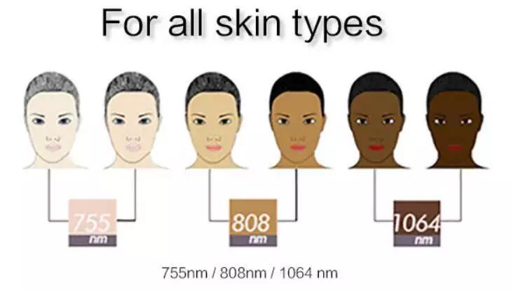 Style Portable 755nm 808nm 1064nm Wavelength Ice Diode Laser Mini Hair Removal Machine