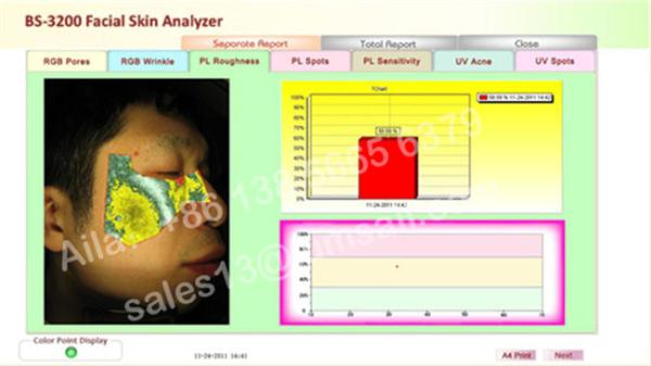 canon camera skin analyzer beauty equipment digital camera visia skin analysis
