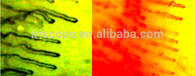 CE Approved LCD Screen Medical Microscope Capillary Microcirculation