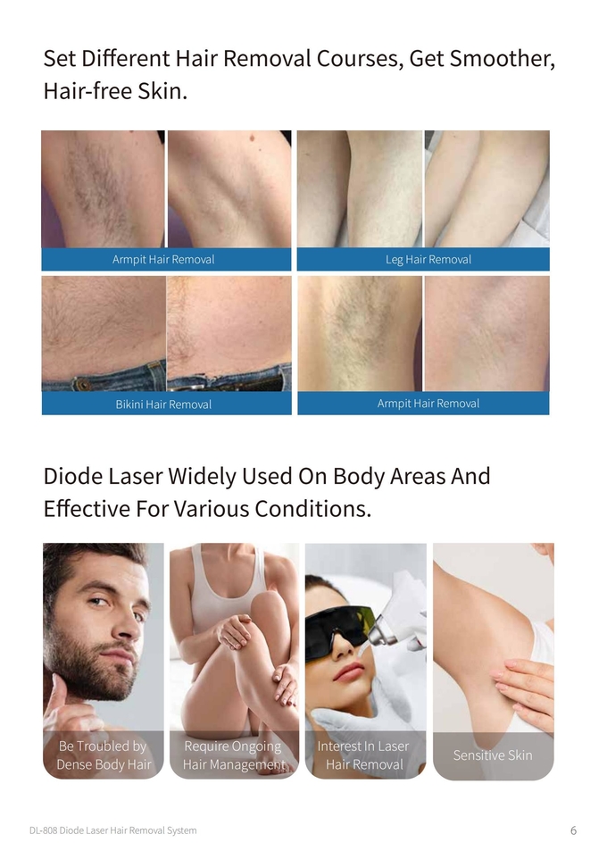 Compact Laser Hair Removal Machine for Aesthetic Clinics Resellers 10 Inch Touch Screen Pulse Width 5-400ms