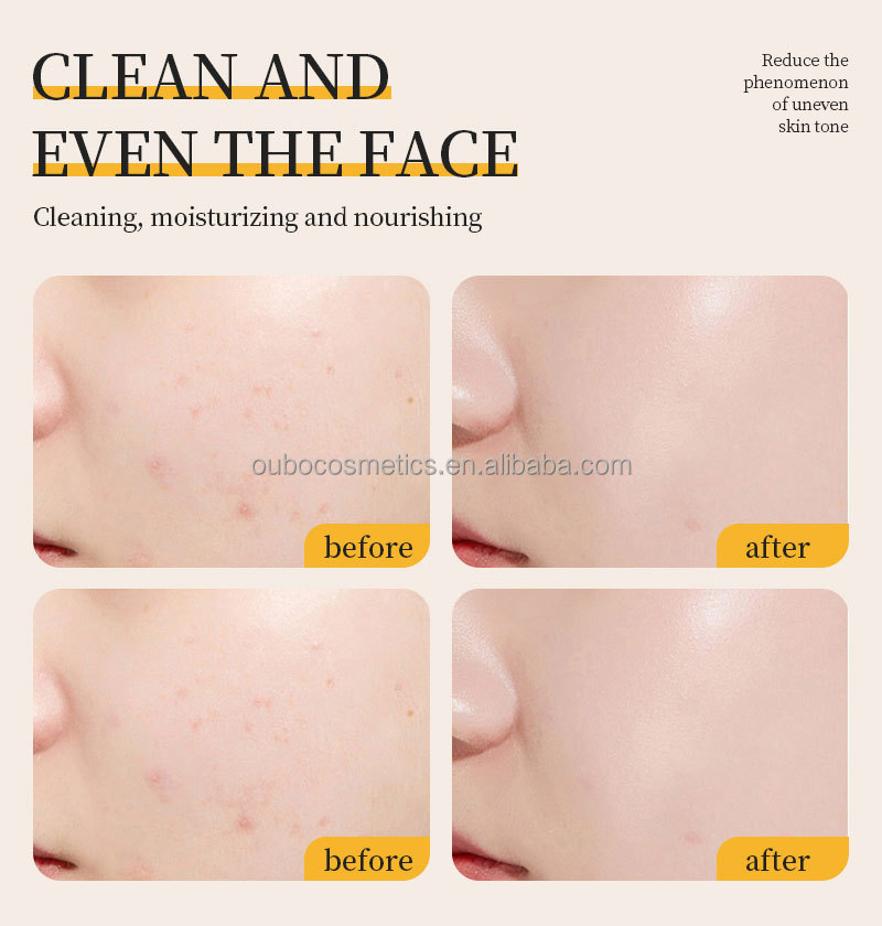 Face Wash Facial Cleanser Whitening Face Wash With Rice Extract for Oily Dry Skin