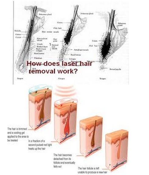 2019 hot sale alexander diode laser hair removal machine