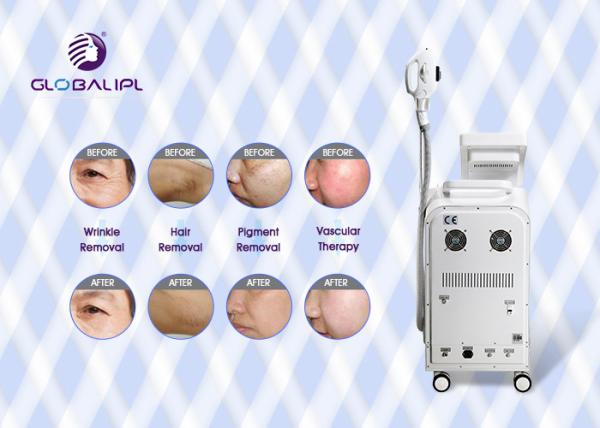 Intelligent Multifunction Beauty Machine Tattoo Removal Skin Rejuvenation With