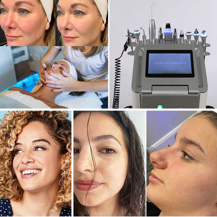 Jet Peel H2O2 Beauty Machine
