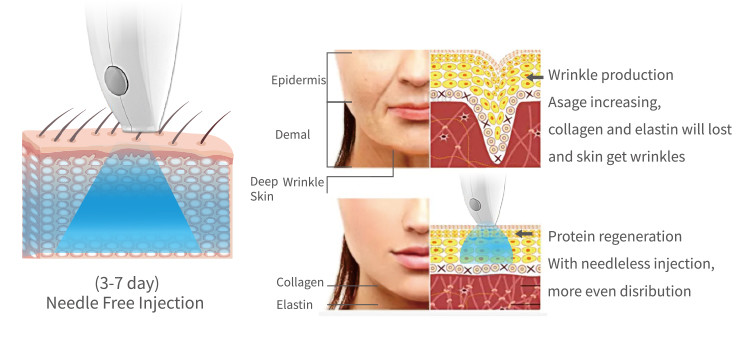 Skin Care Needle Free Mesotherapy Facial Machine With Various Cosmetic Products