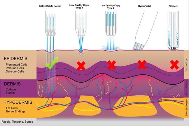 Needle Free Injector Myjet Oxygen jetPeeling Skin For Under Eye Bags Fine Lines And Wrinkles Treatment