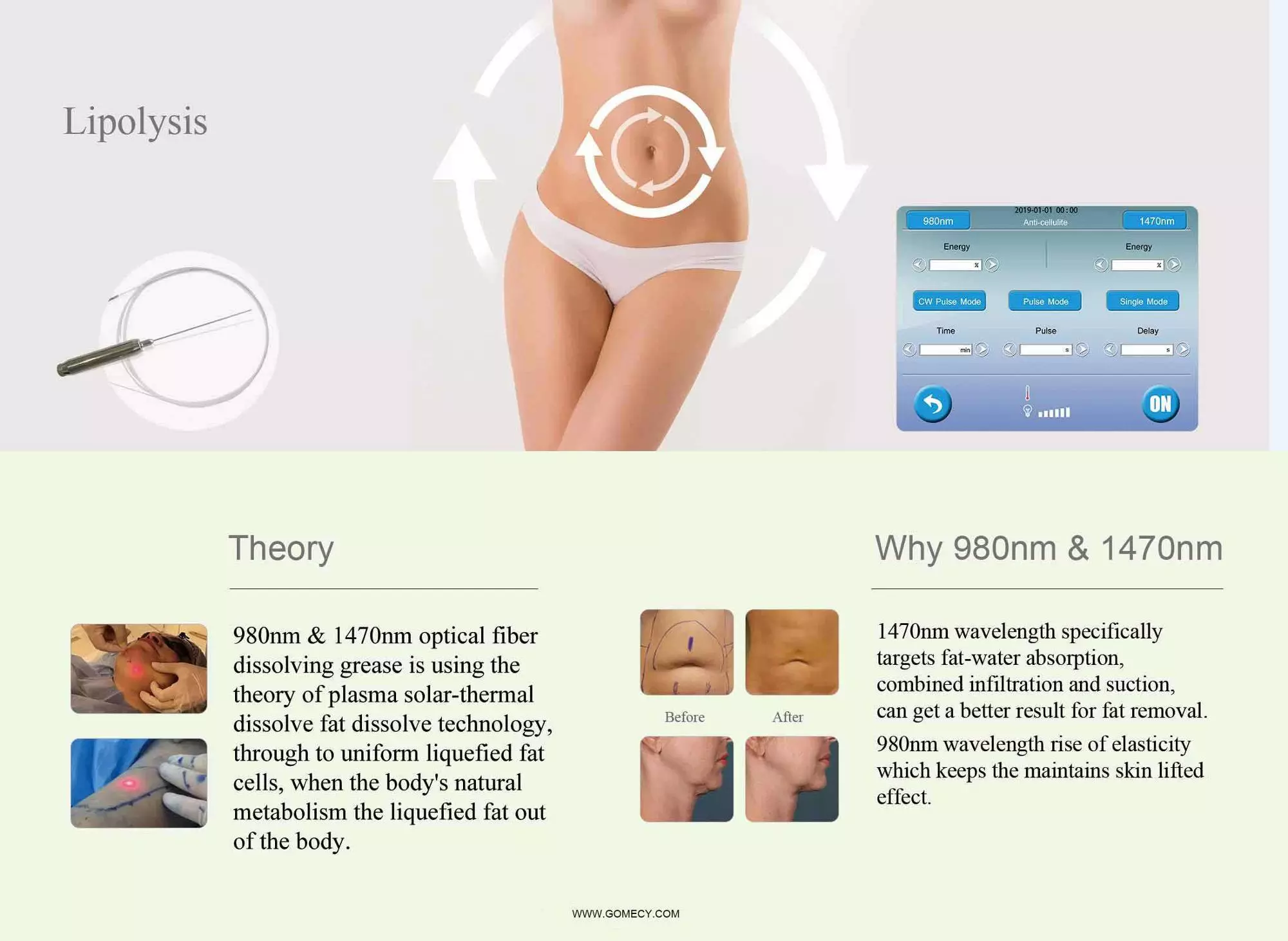 980nm 1470nm Diode Laser Lipolysis Machine For Beauty Center