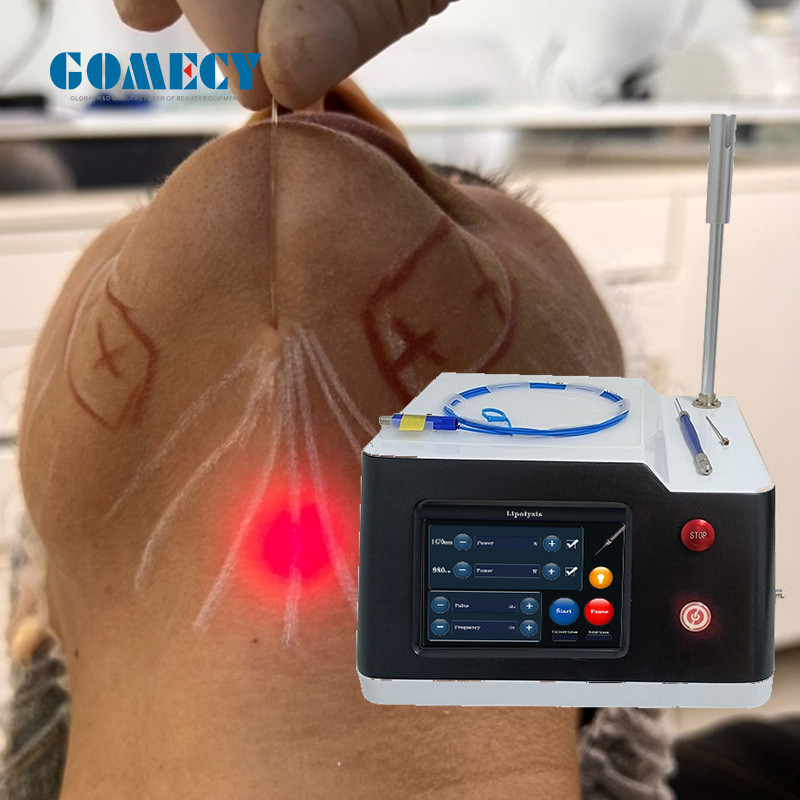 100W Endolift Laser Machine Air Cooling With 7 Inch LCD Touch Screen