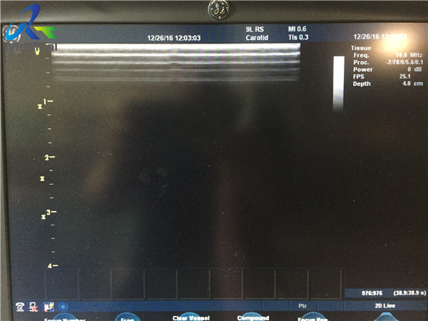Secondhand Abdominal Ultrasound Probe For Vascular Access