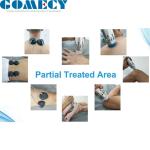 EMS Shockwave Machine , Shockwave Therapy Erectile Dysfunction Machine