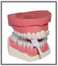 High Quality Dental Aligner Chewies Disposable Aligner Chewies