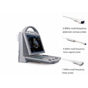 Portable Pregnancy Ultrasound Scanner with Abdominal Convex Transvaginal Transducers