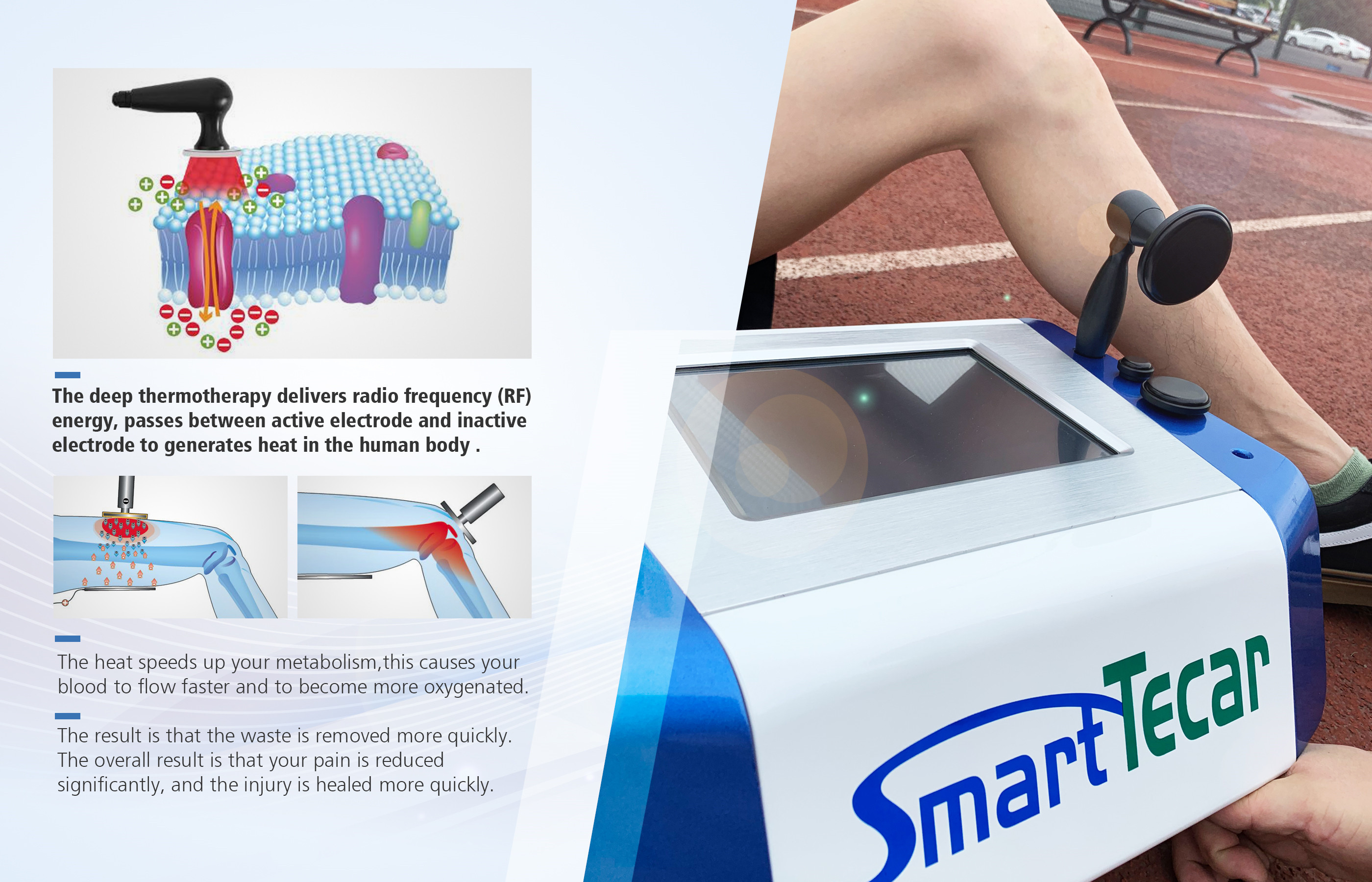 Portable Tecar Therapy Machine For Sports Injury Diathermy RF Tecartherapy Equipment
