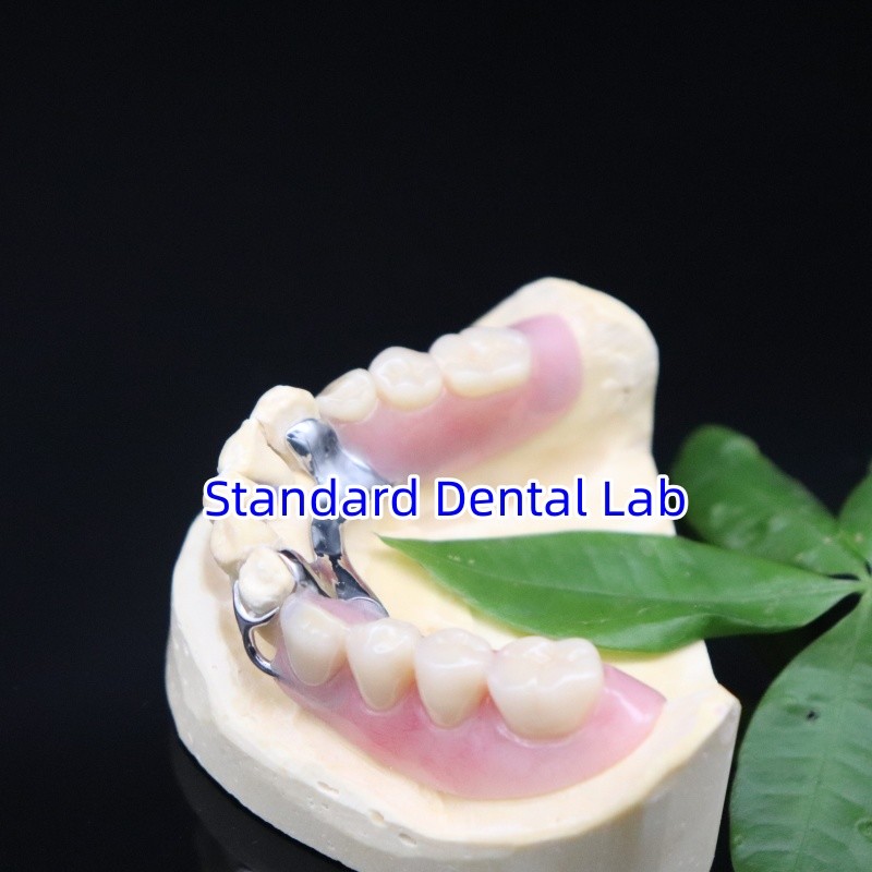 Clear framework Acrylic Metal Partial Denture Frameworks High Esthetics China dental lab