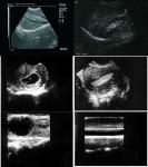 Portable Ultrasound Scanner Color Doppler Machine With 15 Inch LCD Monitor