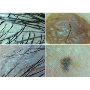Wireless Microscope Digital Dermatoscope Connect To Computer For Skin And Hair Inspection