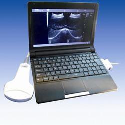 Mobile Hand Ultrasound Machine Ultrasonication Probe Supported Windows / Android