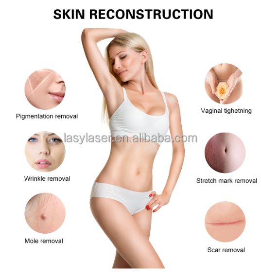 Stationary Fractional Laser Co2 Machine Scar Removal Infrared Skin