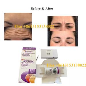  Injection Allergan Botulinum Toxin Type A 100units Anti Aging Manufactures