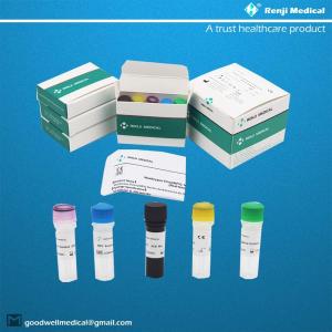 Monkeypox Virus(MPV) Nucleic Acid Detection Kit Fast Test Home Kit Real Time PCR