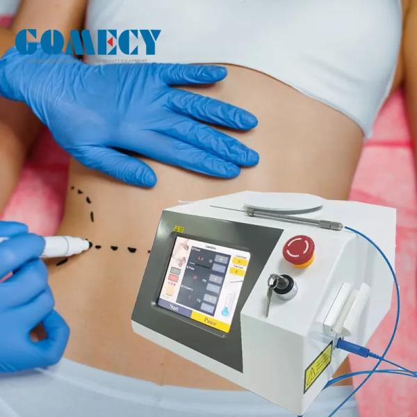 2024 Newest Professional Optical Fiber Endolaser Lift 1470nm 980nm Diode Laser